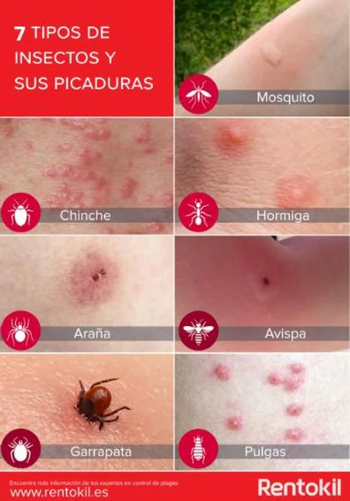 Cómo saber si tengo picaduras de chinches: Guía completa