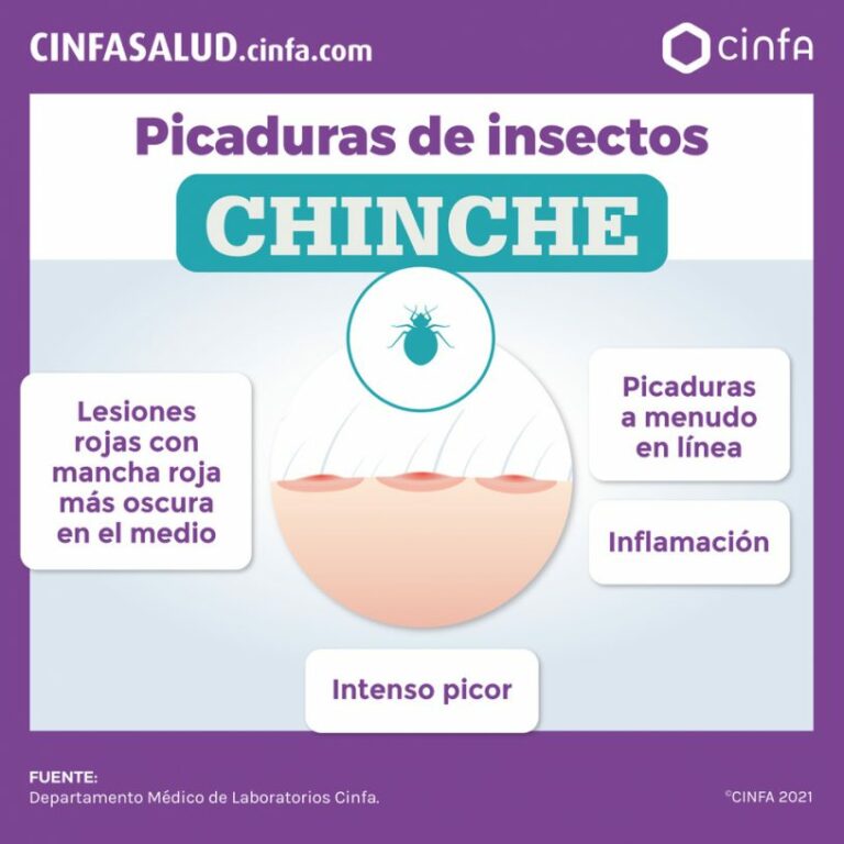 Cómo se ven las picaduras de chinches en la piel: Guía Visual