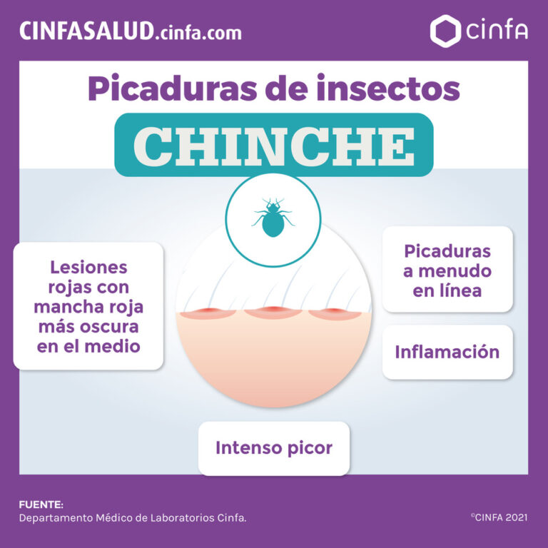 Qué enfermedades causan las chinches: Descúbrelas aquí