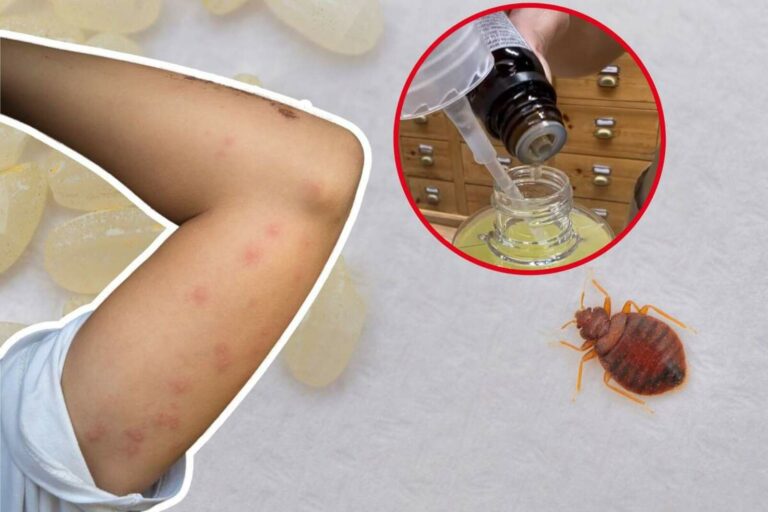 Remedios caseros para matar chinches: ¡Elimina estos insectos!